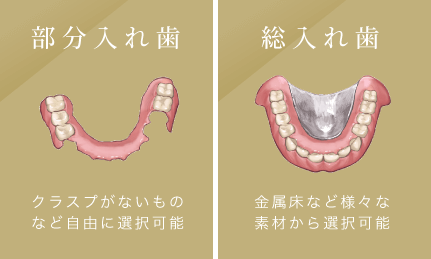 部分入れ歯：クラスプがないものなど自由に選択可能/総入れ歯：金属床など様々な素材から選択可能